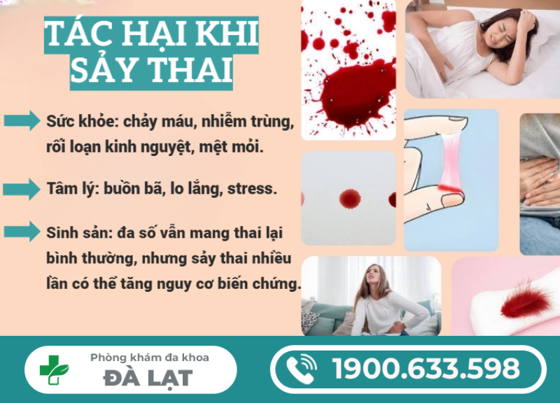 Hình ảnh minh họa